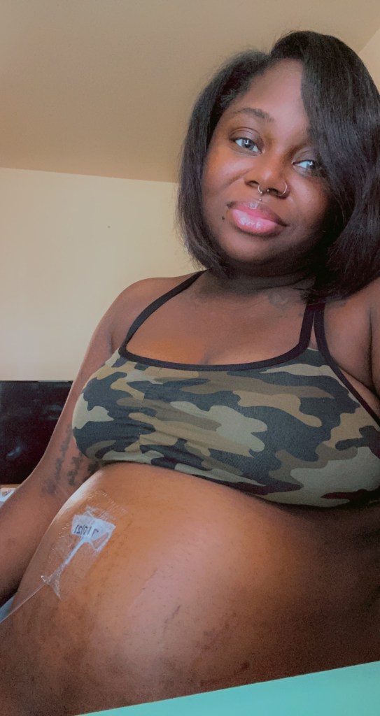 Hyperemesis Gravidarum